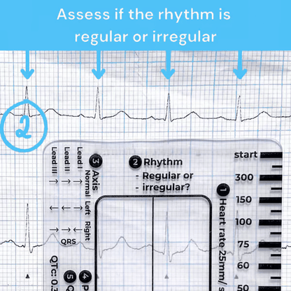 🔥HOT SALE -ECG 7 Step Ruler
