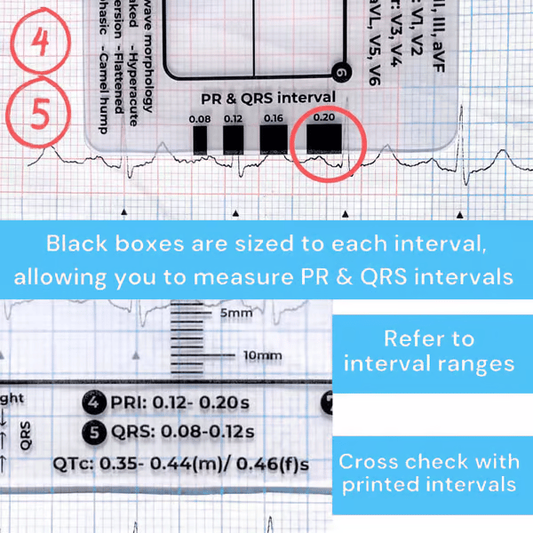 🔥HOT SALE -ECG 7 Step Ruler